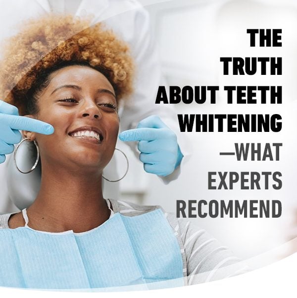 The Truth About Teeth Whitening—What Experts Recommend